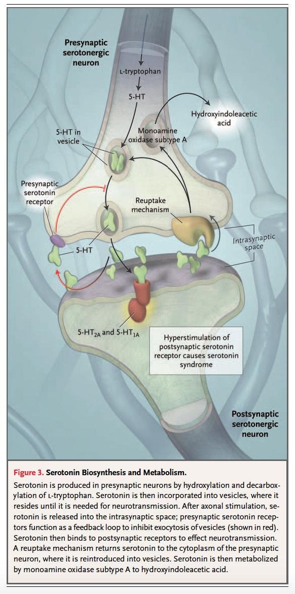 TrackYourHeart's tweet photo. Correct answer: B. Serotonin syndrome

Sustained clonus with hyperreflexia is one of the hallmark bedside signs of serotonin syndrome, a potentially life-threatening condition caused by excessive serotonergic activity in the central nervous system. Patients typically present with a triad of:

- Altered mental status (e.g., agitation, confusion) 
- Autonomic instability (e.g., fever, tachycardia, diaphoresis, hypertension) - Neuromuscular hyperactivity (hyperreflexia, inducible or spontaneous clonus, tremor, muscle rigidity)

https://t.co/wZ472g1DJM…