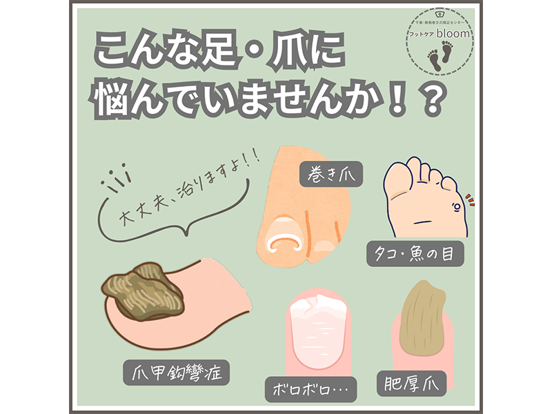 chi_value_net's tweet photo. ／
#健康づくり を応援『ち～バリュ～の店』ご紹介📣
＼
千葉市「フットケアbloom」さん👣
ち～バリュ～カード提示で部分角質ケア無料🌸
初回の方限定
https://t.co/B1ttzuyheS

⏬元気ちば！健康チャレンジ「ち～バリュ～」
https://t.co/T5J5EArGNg https://t.co/FZMoVpum35
