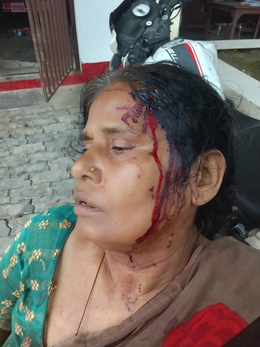 HardoiAnoop's tweet photo. कानपुर देहात के पामा चौकी क्षेत्र के पामा गांव में दबंगों ने घर में घुसकर महिला पर जानलेवा किया हमला, 112 नंबर पुलिस जाने के बाद दबंगों ने घर का ताला तोड़कर की तोड़फोड़, पीड़ित परिवार पामा चौकी में बैठा.@kanpurdehatpol @adgzonekanpur @Uppolice @CMOfficeUP https://t.co/vYqFkJ0BFH