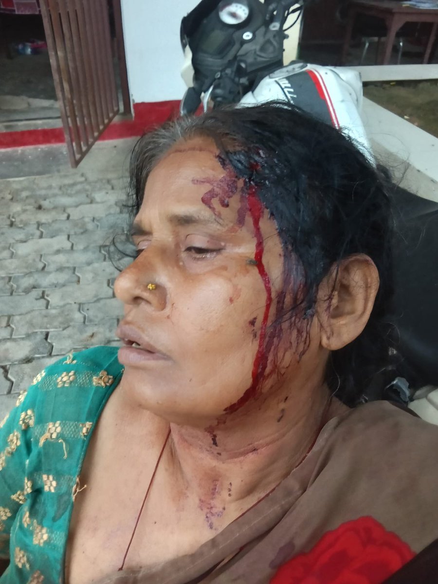 HardoiAnoop's tweet photo. कानपुर देहात के पामा चौकी क्षेत्र के पामा गांव में दबंगों ने घर में घुसकर महिला पर जानलेवा किया हमला, 112 नंबर पुलिस जाने के बाद दबंगों ने घर का ताला तोड़कर की तोड़फोड़, पीड़ित परिवार पामा चौकी में बैठा.@kanpurdehatpol @adgzonekanpur @Uppolice @CMOfficeUP https://t.co/vYqFkJ0BFH