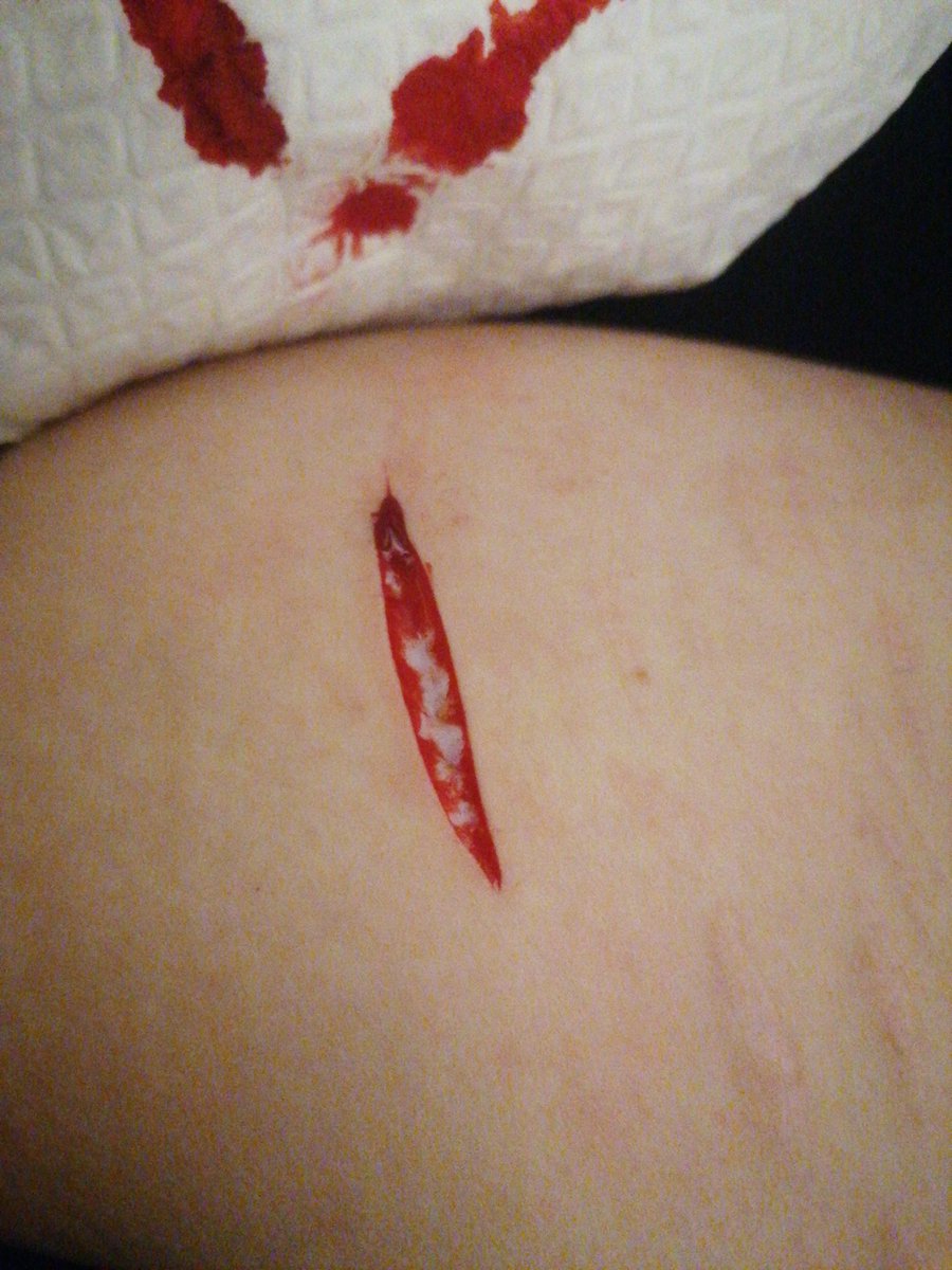 Fridgee_ee's tweet photo. Some cuts I really liked
ALL FAKE, SFX MAKEUP, AI
#shtwt #shedtwt #ouchietwt #slittwt #cuttwt #sfxmakeup #fake https://t.co/BTouqFadhS