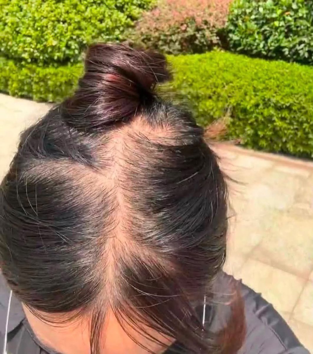 faradistyy's tweet photo. Mba mba guardian yg dulu saranin gue pake serum ini thank you bgt ya.. kalo gue ga jadi milih serum ini kayanya pitak terus ni rambut 😭🙏🏻￼ https://t.co/Uka2utwZ4O