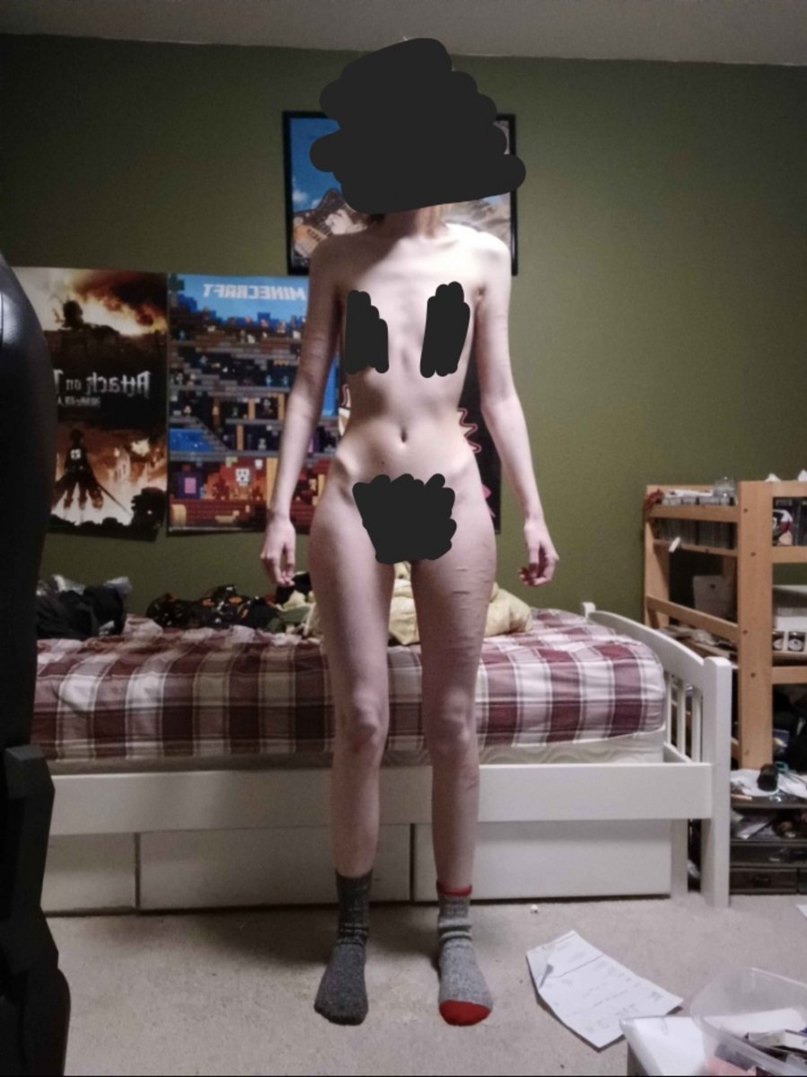 Totallyexisten7's tweet photo. #bodycheck #edrtwt do I have some spine and shoulder blade abnormalities? my body is so disgusting I hate knowing this is what's hidden under my clothes its all I think about. BMI 15.3 https://t.co/UmpE6maAQN
