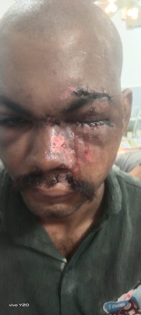 rk555309's tweet photo. @siddharthnagpol @bstvlive @siddharthnagpol
 महोदय,
संदर्भित प्रकरण में आपने प्रभारी निरीक्षक इटवा को आवश्यक कार्यवाही हेतु निर्देशित किया था। कृपया बताएं कि अब तक क्या ठोस कार्रवाई हुई है?  क्या आरोपी अनिल सोनी के खिलाफ मुकदमा/एफआईआर दर्ज हो चुकी है?  
आरोपी को गिरफ्तार किया गया या नहीं? https://t.co/qxTxdw5cZw