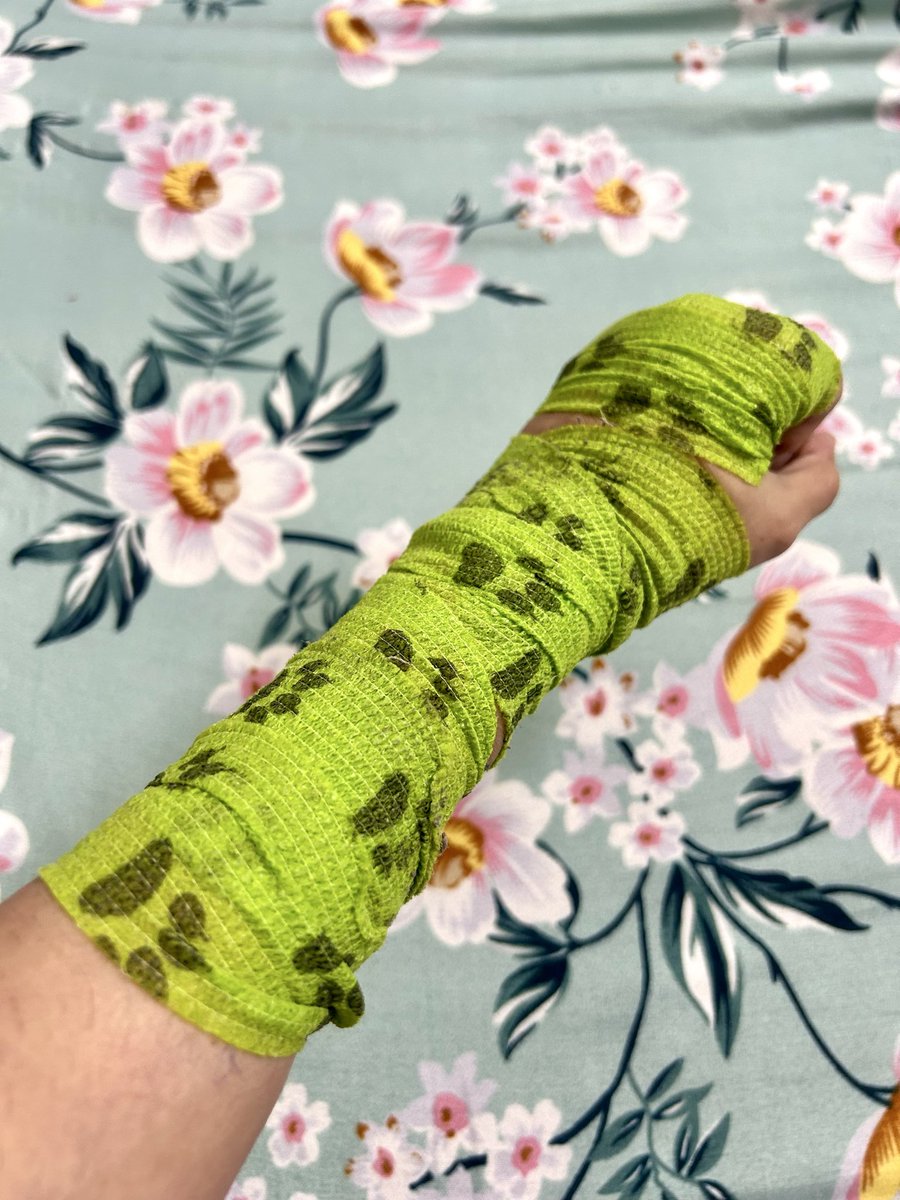 aliaskoyal's tweet photo. Today it’s the left hand but two days ago, it was my right. How I wish these were my boxing wraps but they’re doggie wraps because the veins are acting up again. Grrr 🦁 https://t.co/NOEBFAoNUS