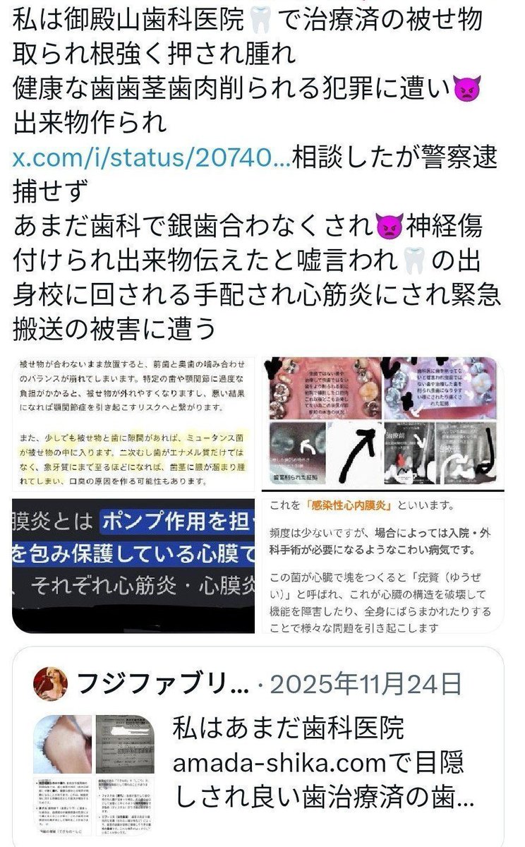haruma11111's tweet photo. #CDTVライブライブ #島袋寛子 氏🎤の体調不良は望んだ事ではなくは🎤は
歯科に通ってました
私は健康な歯歯茎歯肉削られ🦷る犯罪に遭い
虫歯歯周病にされ菌周り👿胸痛し緊急搬送
🦷👿体調不良発症ある為
薬害AIDS事件
B型肝炎事件
点滴異物混入事件同様事件の為
🦷👿れた
被害者大勢いる為
改善応援🙇♀️ https://t.co/H84MWaybMb