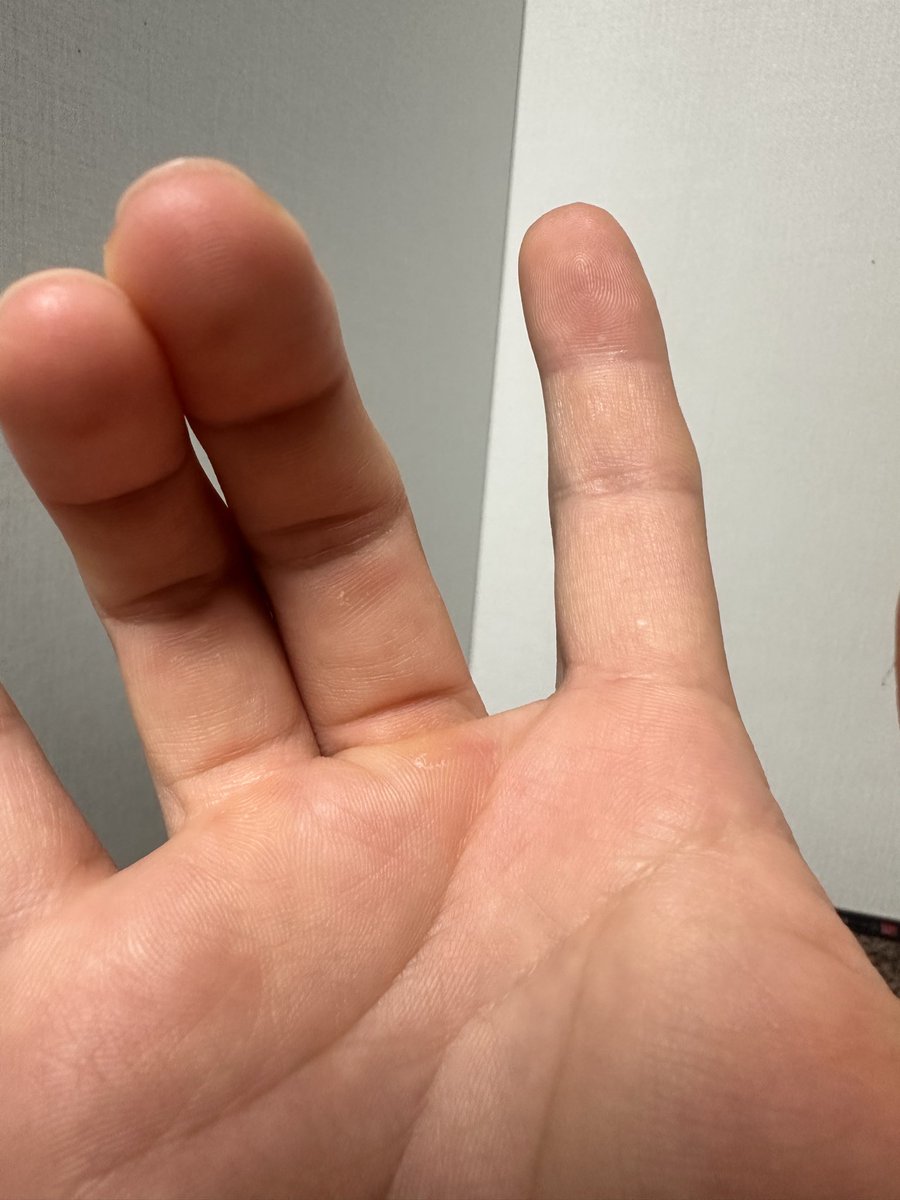 teimeobr's tweet photo. 만져질사람?? 있을까? https://t.co/zVukiHgQV7