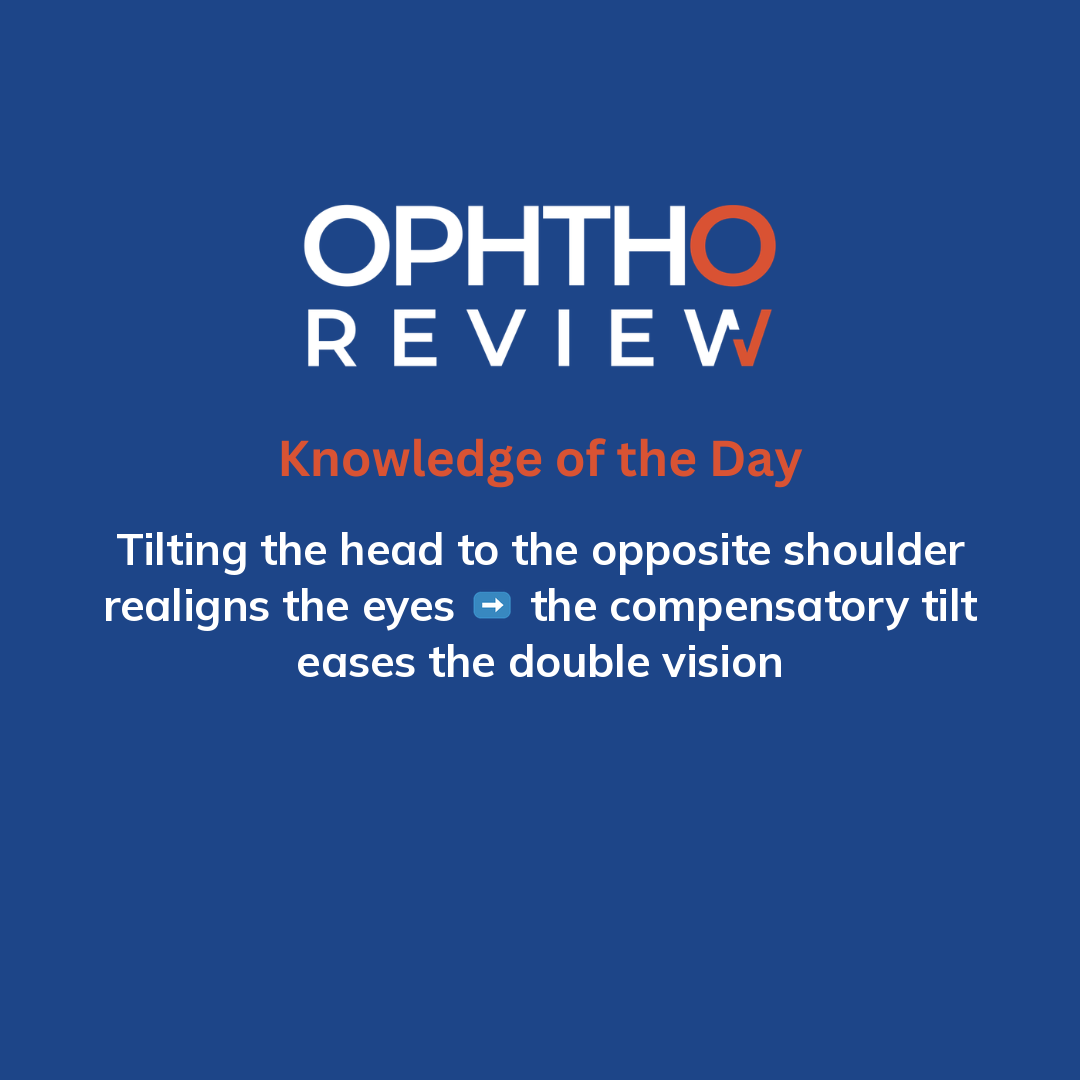 ophthoreview's tweet photo. Trochlear nerve palsy

#ophthoreview #ophthalmology #ophtho #ophthalmologyresidency #ophthalmologist #surgicaleducation #medicaleducation #meded #surgery #medicalstudent #medicine #medicalschool #resident #residency https://t.co/jRuQoSEeww