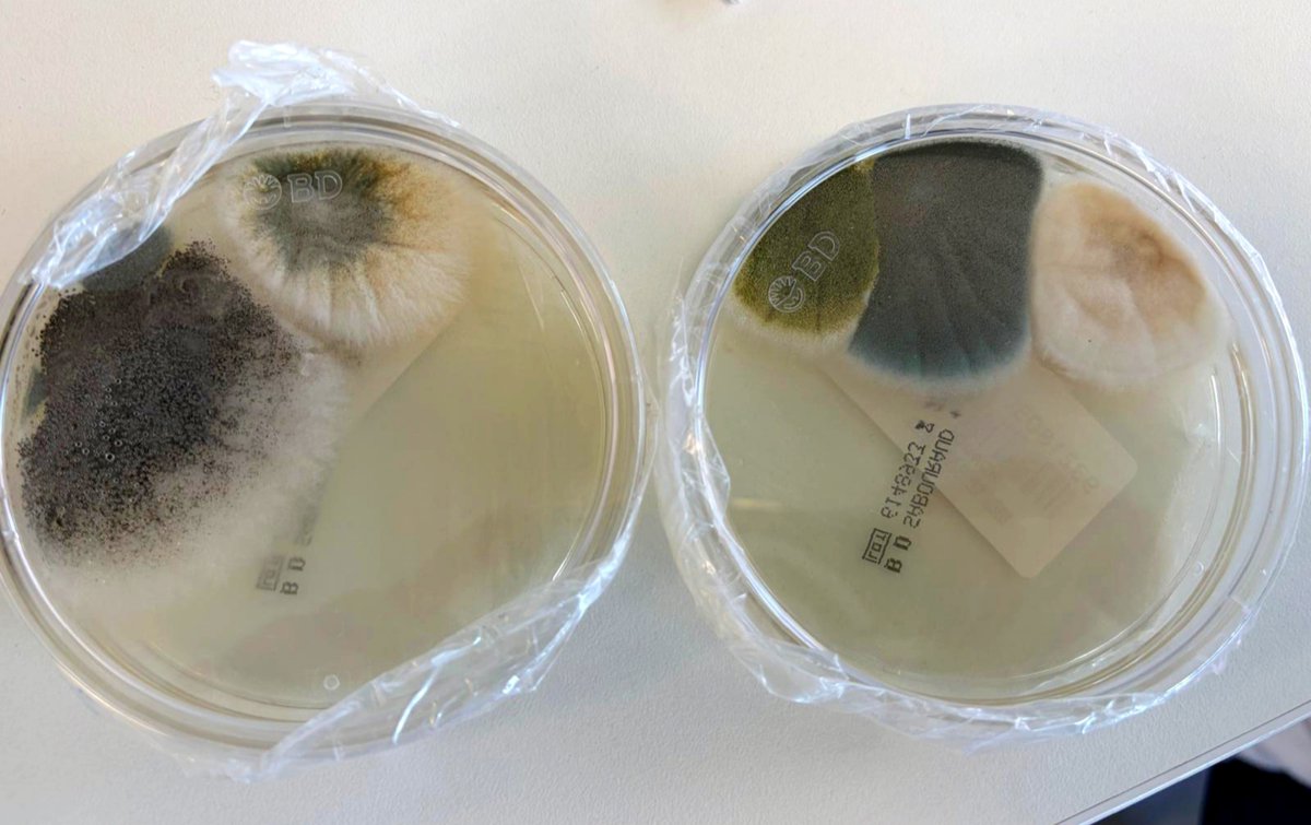dios_caballero's tweet photo. Cultivo de esputo de paciente con bronquiectasias. Ha crecido todo el elenco aspergilar (A. niger, A. nidulans, A. flavus, A. fumigatus y A. terreus). Se diría que han salido en fila india del paciente 😅 https://t.co/6SMPqTEDXs
