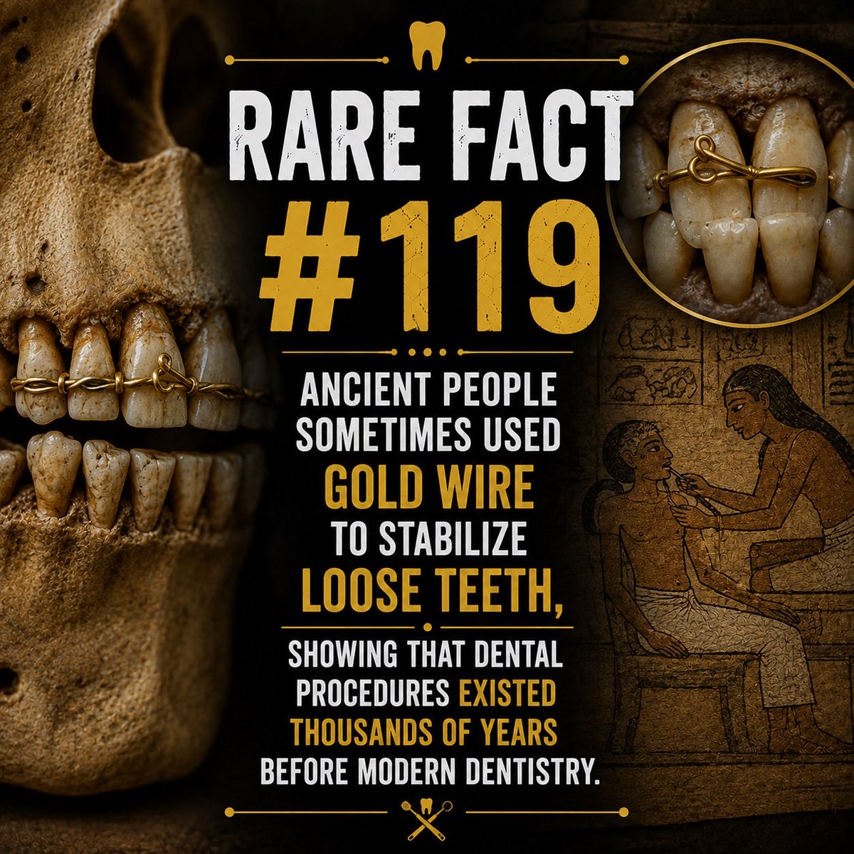 knowledgehub101's tweet photo. Dentistry is far older than you might think 🦷✨  

Long before modern dentists, humans were finding surprisingly sophisticated ways to save a smile. 🤯

#RareFact #History #Dentistry #Archaeology #DidYouKnow https://t.co/dR9BzxBpGV