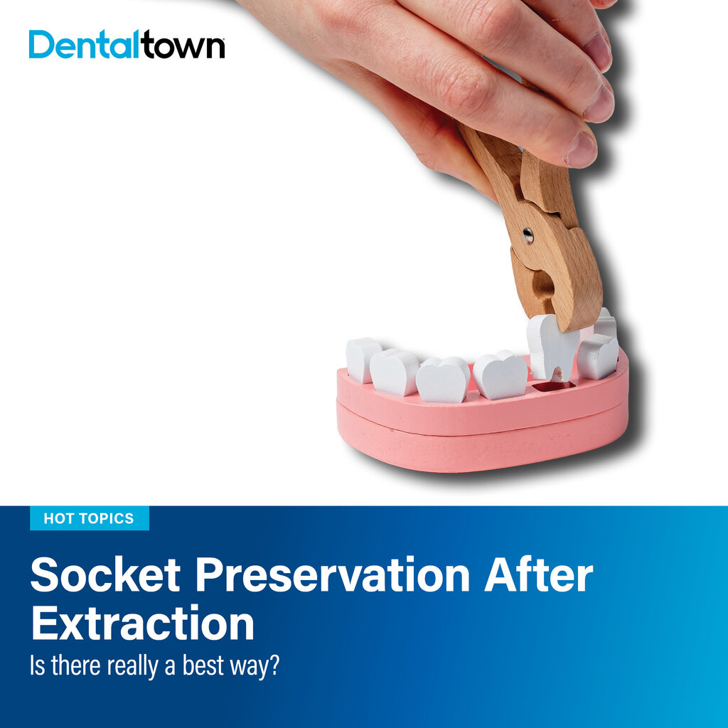 Dentaltown's tweet photo. Is there really a best material for socket preservation? 
This piece says success depends less on the product and more on the case. 

➡️ https://t.co/NNGARYcosU 

#Dentaltown https://t.co/3A4psyXNiY