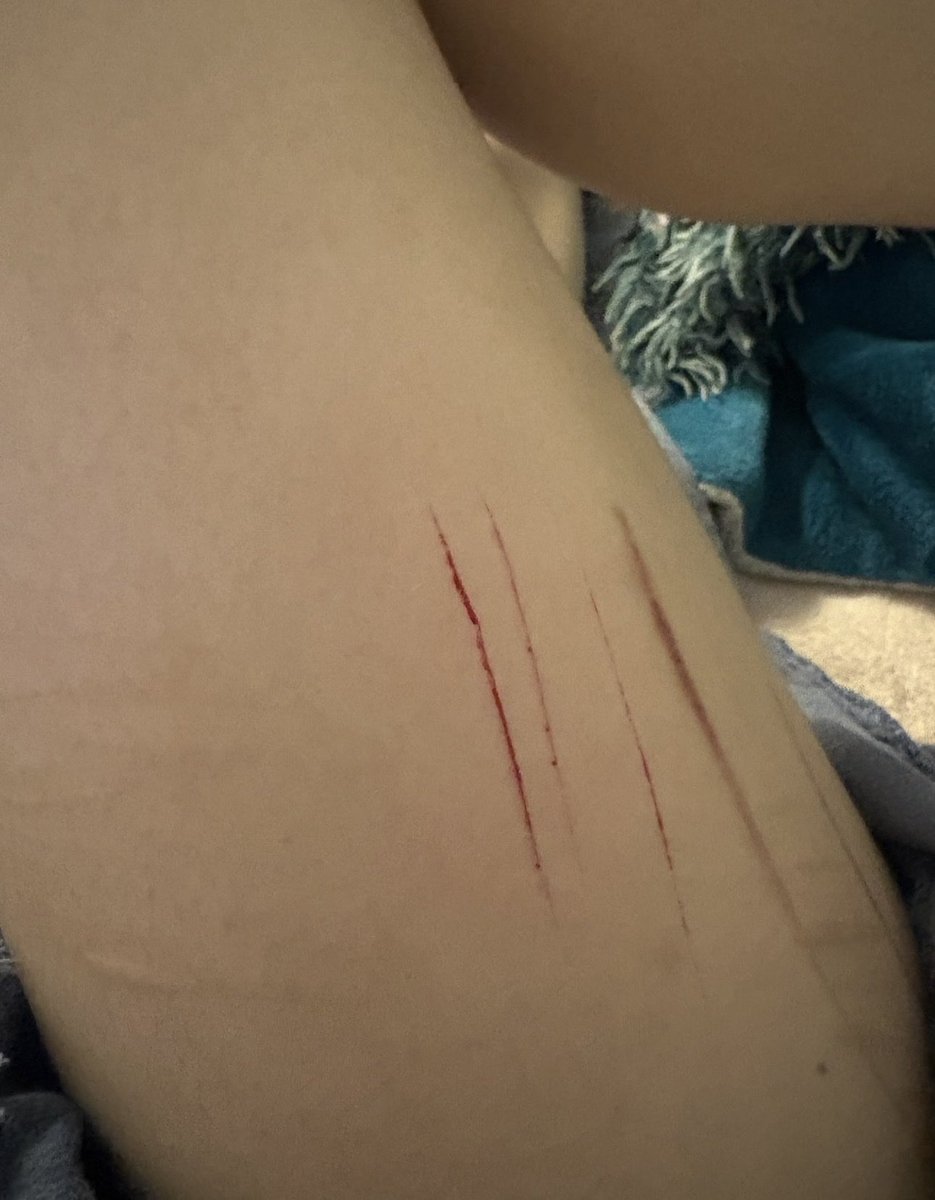 kelp330's tweet photo. small sesh

fake sfx makeup https://t.co/F79CSnx8hg