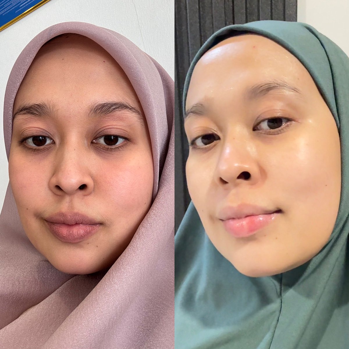 dhirvnvzri's tweet photo. Terima kasih akak millennial. Tips skincare FOMO memang menjadi! 

No more foundation! https://t.co/uayXRhuTjJ