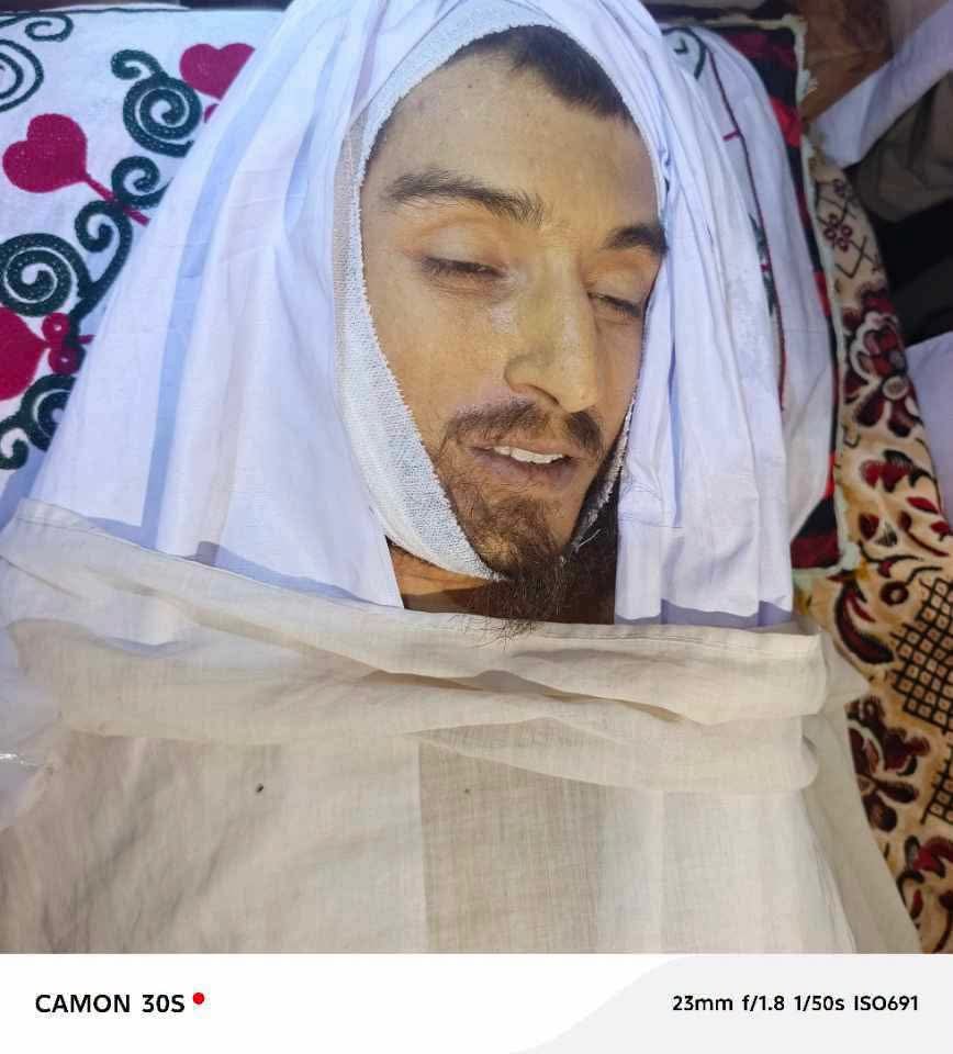 ptmlakkimarwat's tweet photo. حبیب اللّٰہ ولد اشرف علی جانی خیل بنوں کو 2 سال پہلے امتحانی مرکز سے واپسی پر چیک پوسٹ سے لاپته کردیا تھا اور ابھی ٹھیک 2 سال بعد اسکی لاش کو گھر والوں کے حوالے کردیا ہے۔ 
#PashtunLivesMatter #StopStateTerrorism https://t.co/3YQbvblFcL