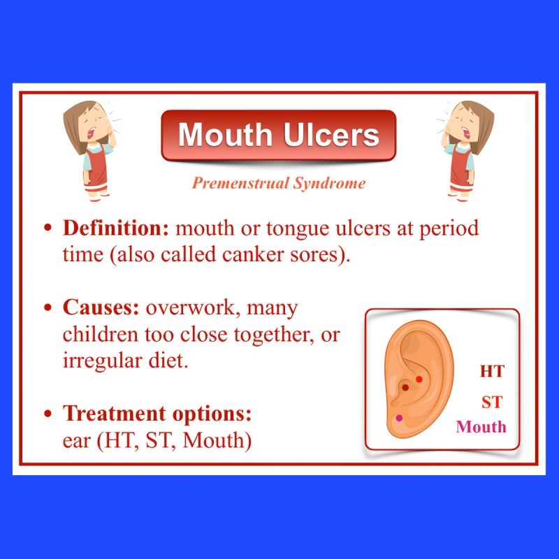 AcuProAcademy's tweet photo. Mouth ulcers around your period? 👀💜 In TCM, the key is to look beyond the symptom and understand the underlying pattern. 🌷
🌱If you enjoyed my graphics, check out my illustrated guide to treatments for over 160 common syndromes here:
👉 https://t.co/HDVJ1QAS4g

#pms #tcm https://t.co/3fksIkBDQi