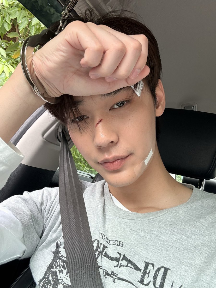 derechodevil's tweet photo. don’t mind the wounds it’s bc i’m gay https://t.co/lEv9M3x9L8
