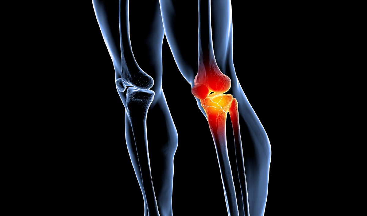 SamaritanMin's tweet photo. Are you having ACL repair surgery soon? You don't have to handle it alone. 

Samaritan Ministries offers information on ambulatory surgical centers around the country that offer fair prices and quality care. 

👉 Learn more: https://t.co/D7ZxNpCg3i https://t.co/3MkQDFga8S