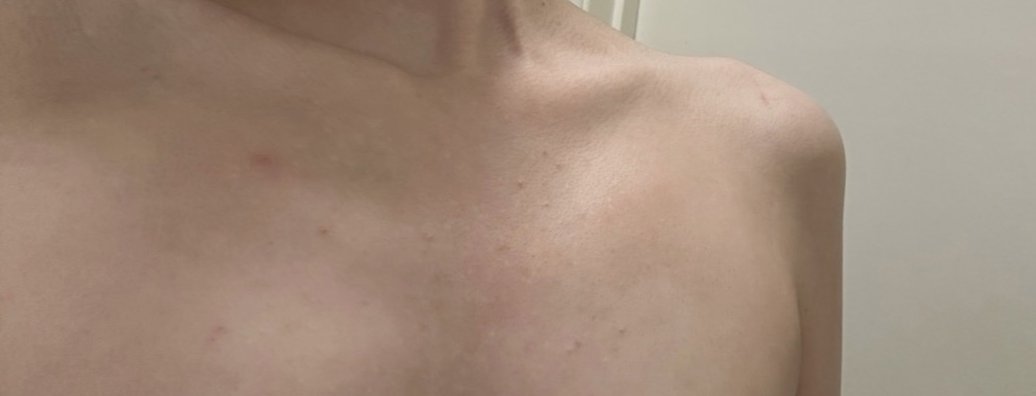 Dreamy_chae's tweet photo. do you guys see that too or am I tripping balls (ignore the acne🫤)  #edrtwt #ricecaketwt https://t.co/3PXiNOdh0Y