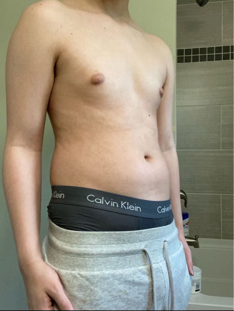 g00nergainer's tweet photo. before/after about a year of gaining and gooning addiction 😵‍💫160-230 https://t.co/NAUG39rWM9