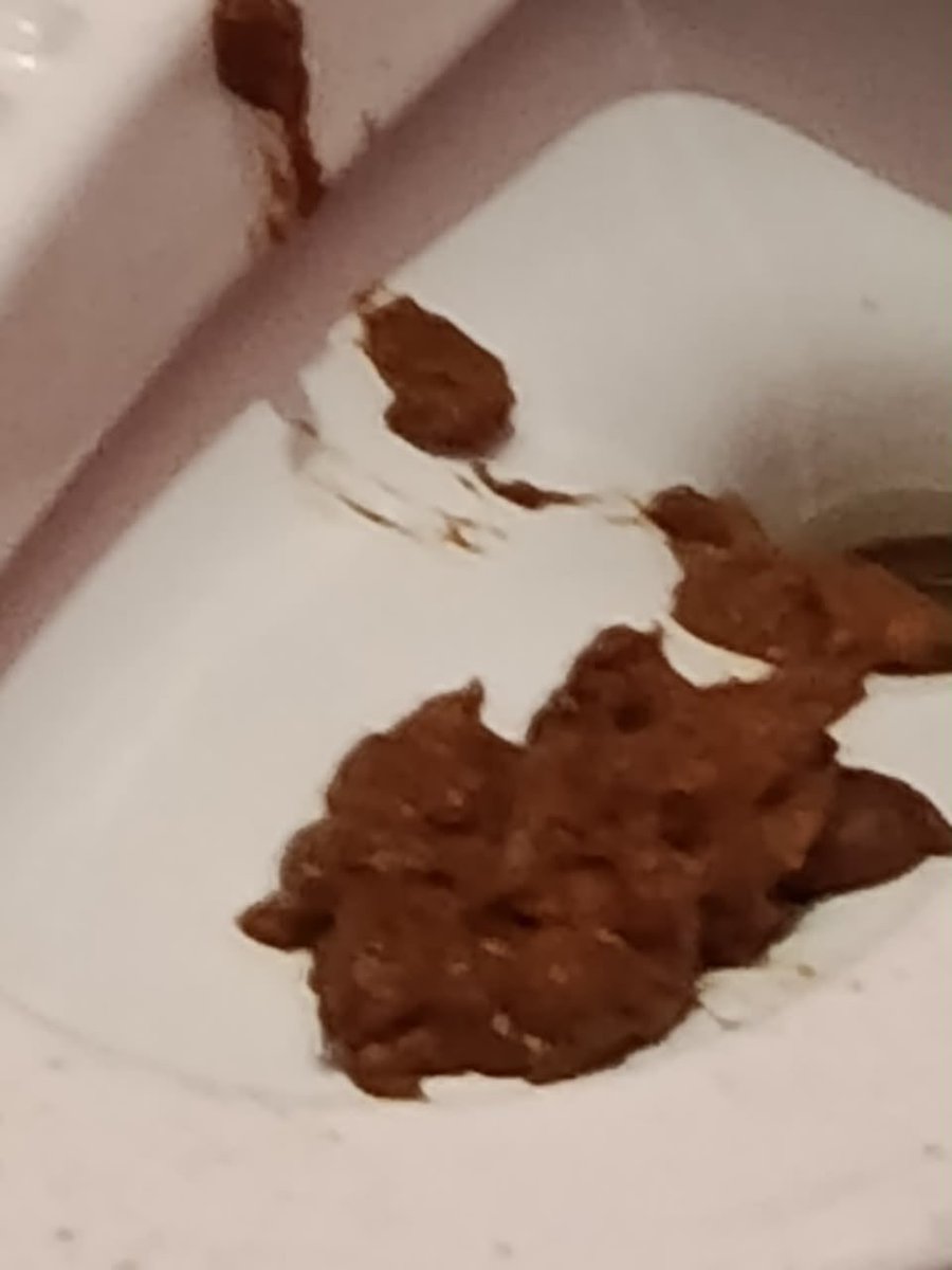 Goddessany1n's tweet photo. I want to keep feeding my slaves with my shit 💩 all day… it’s nutrient deficiency 💩💩🚽🚽 https://t.co/HUXKaeuKJD
