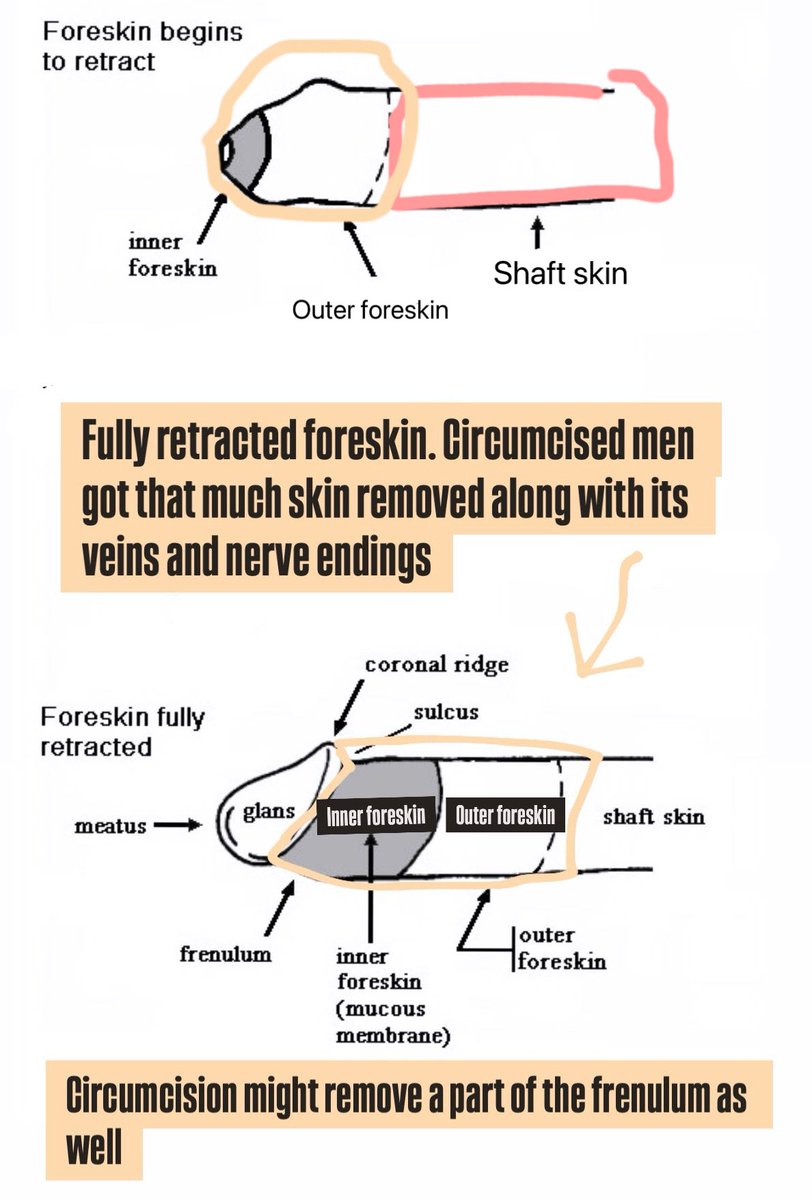 KemKozlov's tweet photo. Functions of foreskin every man should know about: https://t.co/68wDHFADrD

Foreskin and the frenulum rubbing and gliding up and down the glans is the most heavenly body euphoria a man can have. 

List of studies and researches expose the harm of circumcison: https://t.co/nAU2kkAFSv 

How extreme pain negatively effect newborns short-term and long-term: https://t.co/MHgSamuBoz

Why all mammals have their penile glans covered when not aroused: https://t.co/6hCS1XmYc2