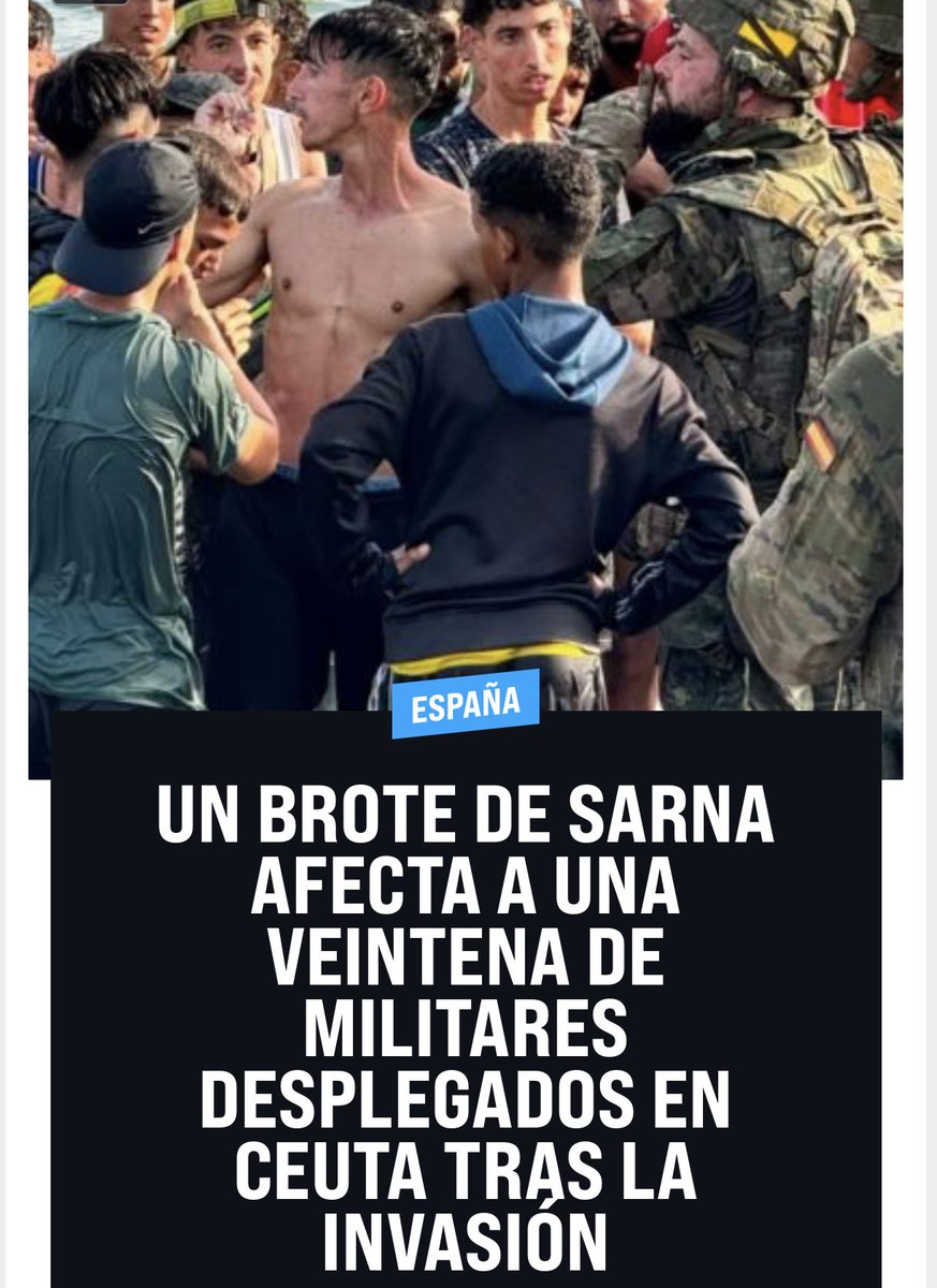 Perrroloco7's tweet photo. sarna, ni más ni menos…Sarna. https://t.co/ZvHDQo9a8T