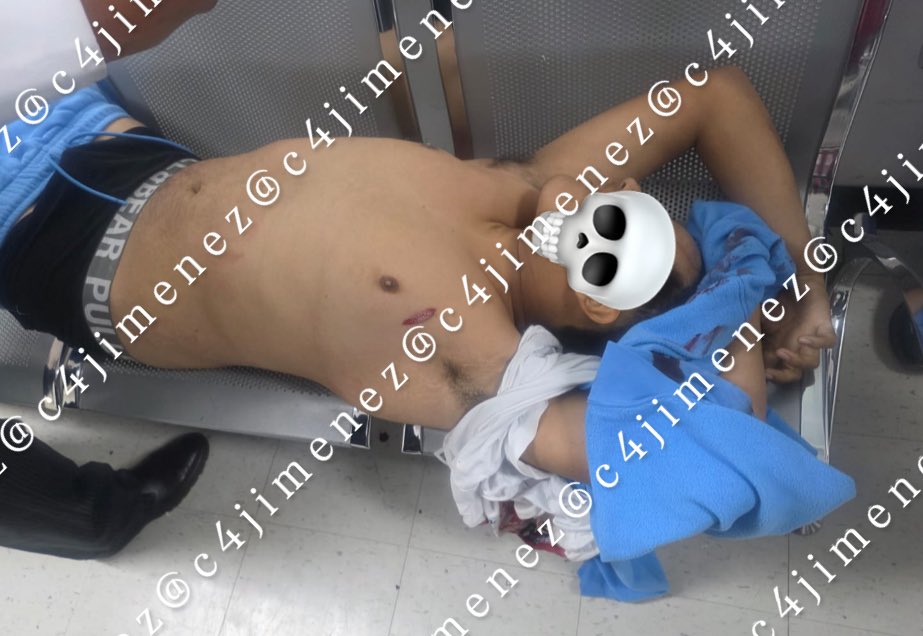 c4jimenez's tweet photo. EN IG / EN C4
Justin Tadeo Madrid Cedillo.
17 años
Formaba parte de un grupo q andan armados, amenazando, disparando… jodiendo en El Peñón de Los Baños @A_VCarranza
-Así se lucia en redes, con su pistola y su cuate lacra.
-Así acabó: muerto en la banca de un hospital.
Lo bajaron a balazos.
@SSC_CDMX y @FiscaliaCDMX indagan.

El caso #C4EnAlerta