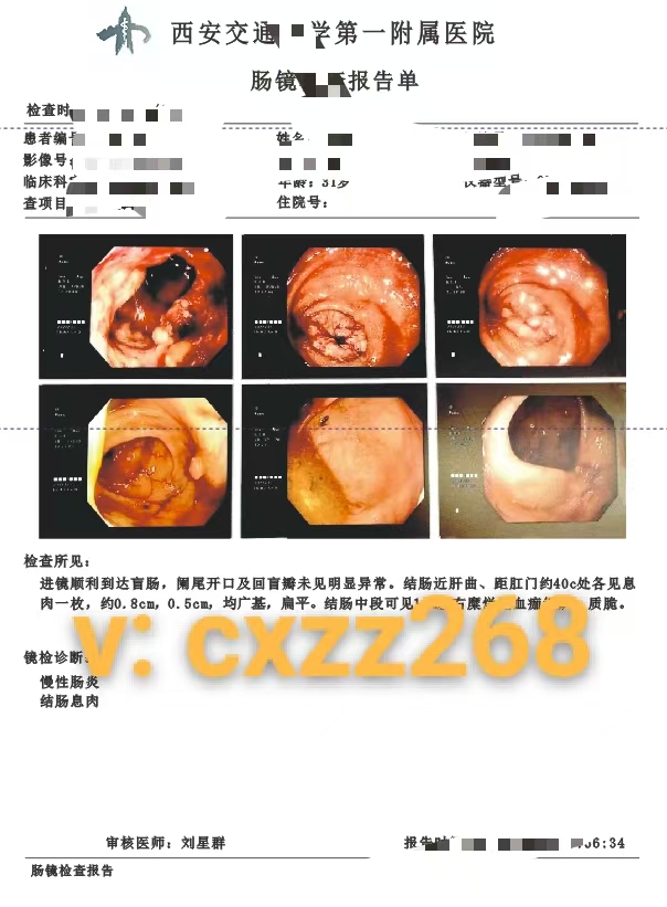 DeboraSantosca's tweet photo. 天津病历单
苏州病历单图片
天津病例单子图片
病历
天津病历本图片
医院病历怎么查
天津病历书写标准
天津医院诊断证明书图片
找病历去哪里找
病例一般多少页
天津儿童医院复印病历流程 https://t.co/Cn7fqe5yUB