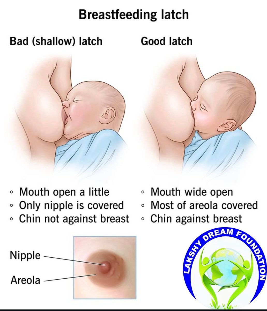 DreamLakshy's tweet photo. Brestfeeding week 1-7 August
https://t.co/TUFh4sJsKo
#Brestfeeding #Health #Community #Children #Global #Worldwide
@UN @UNESCO @WHO @WorldBankGroup @WFP @wef @UNICEF @UNDP @Mrjaykumar2Jay https://t.co/6iomVYkvNI