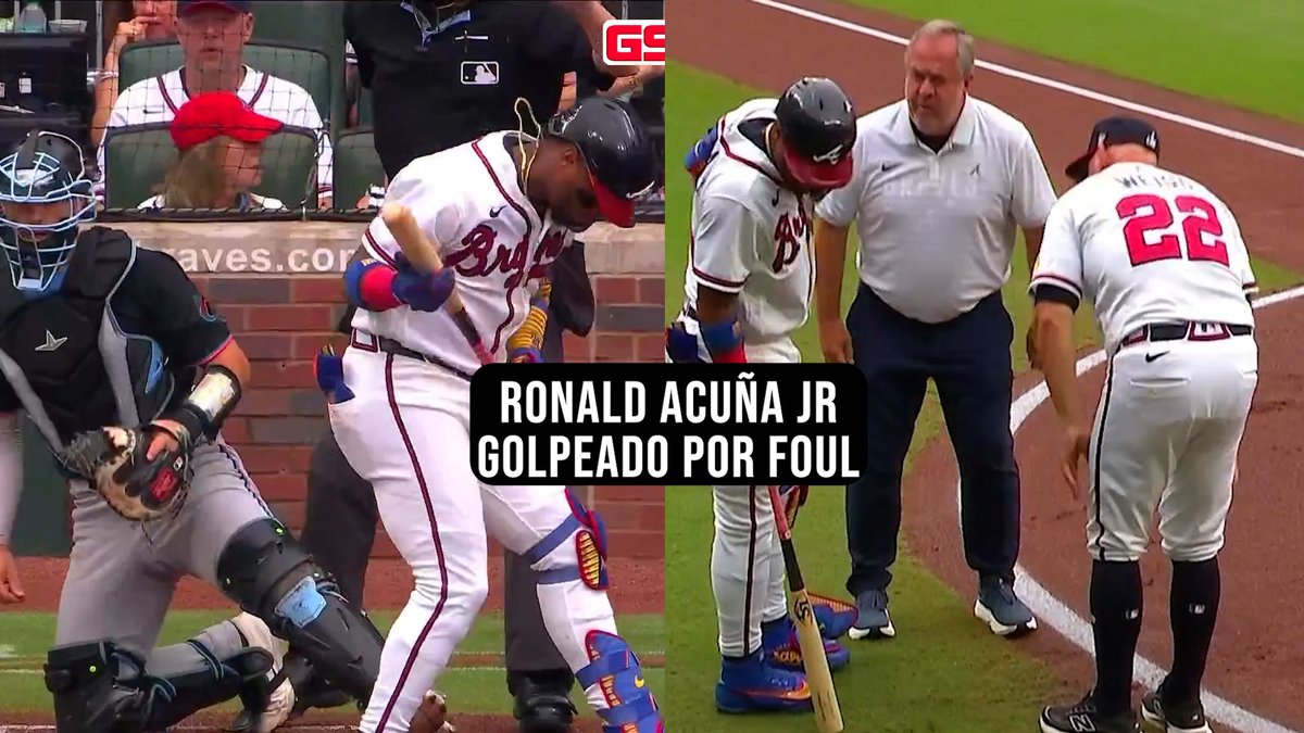 GrandSlamInter's tweet photo. RONALD ACUÑA JR se golpeó la pierna con un foul y luego conectó hit en su primer turno.

MIAMI MARLINS VS ATLANTA BRAVES - Truist Park - 05/08/26  #MLB #ronaldacuñajr #atlantabraves #tiburonesdelaguaira #venezuela #acuñajr #5ago RT https://t.co/TxvU8nX8k2