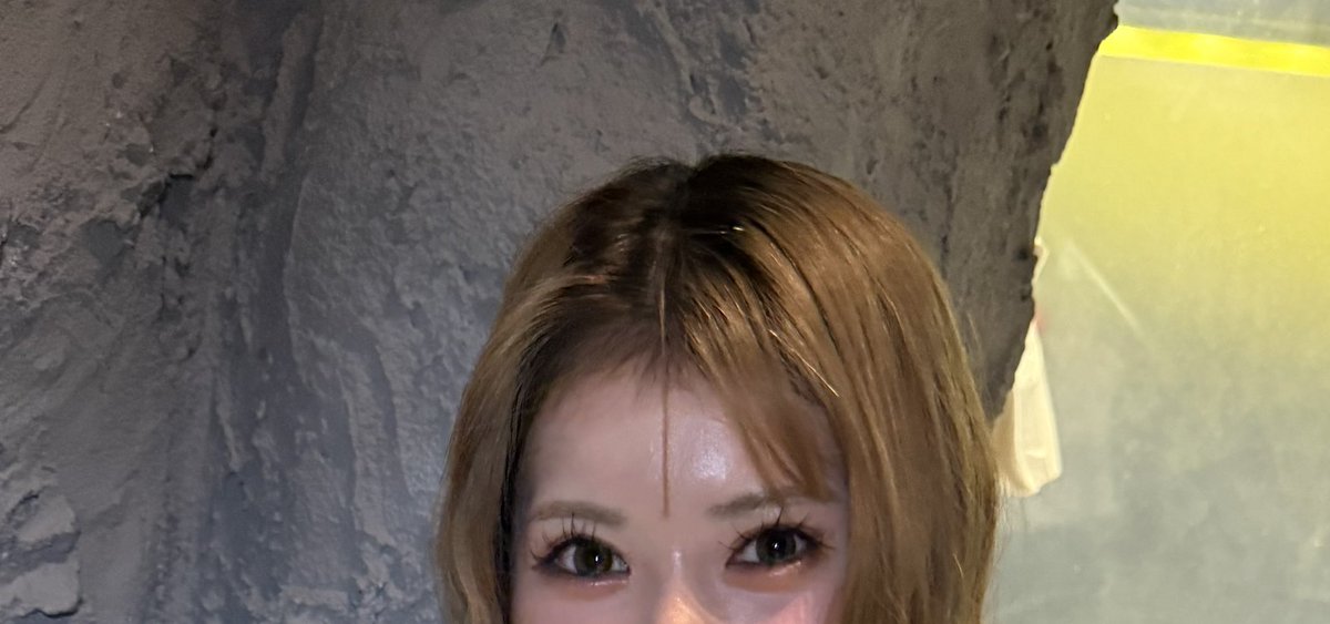 shuumai_karasu's tweet photo. オンユ美容整形外科のオム先生に額挙上の手術をしてもらいました！！
１ヶ月が経過して、まだ傷跡に赤みはありますが、傷跡も綺麗で目の開きも良くなり大満足しています！
術前の質問や、術後の腫れケアや、痛みにも丁寧に対応してもらい、安心してオペが受けられました！
@onyoops_jp https://t.co/1Y3uACoBz7