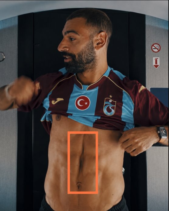 subidurr's tweet photo. Salah'ın karnındaki bu izin sebebi ne bilen arkadaşlar açıklayabilir mi lütfen? https://t.co/htTm5fIzTE