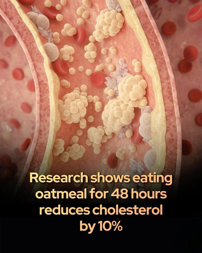 ShiningScience's tweet photo. 🥣 Just 2 Days. One Simple Food. A 10% Cholesterol Drop

What if fixing your cholesterol didn’t take months… but just 48 hours?

Scientists just found something wild. In a new study, people followed an oat-focused diet for only two days — and their bad cholesterol dropped by 10%. No pills. No extreme fasting. Just plain oats.

Here’s where it gets even more fascinating 👀
Participants ate mostly cooked oats for 48 hours, with water and small amounts of fruits or vegetables. Compared to a normal low-calorie diet, oats didn’t just work better — they worked differently. The benefits weren’t from eating less… they came from what oats do inside your body.

The real magic happened in the gut. Those two oat-filled days reshaped the gut microbiome, switching on helpful bacteria and shutting down harmful ones. These good microbes started producing natural compounds that help the body handle cholesterol and blood sugar better. Think of it like hitting a reset button for your metabolism.

And the most surprising part?
The benefits didn’t disappear after the oats stopped. The improvements lasted for six weeks.

This study suggests something powerful: short, focused diet changes — when done right — can trigger long-lasting health effects. Sometimes, it’s not about doing more… it’s about choosing one smart thing, at the right time.

So next time you see a simple bowl of oats… remember: it might be doing far more than just filling your stomach. 🧠💙

Would you try a 2-day oat reset if it could help your heart?