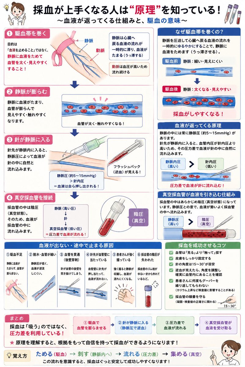 iroiroYI's tweet photo. 【採血が上手くなる人は”原理”を知っている💉】

採血は技術だけではありません。

「なぜ駆血するの？」
「なぜ血液は勝手に出てくるの？」

これを知るだけで、採血の見え方が変わります。

🧵

①なぜ駆血帯を巻くの？

駆血帯は

❌血液を止めるため

ではありません。

目的は

静脈に血液をためて、血管を太く・見えやすくすること。

動脈は血圧が高いため流れ続けますが、

静脈は圧が低いため、
駆血すると心臓へ戻る血液だけが一時的に流れにくくなります。

その結果…

🩸静脈に血液がたまり
⬇️
血管が膨らみ
⬇️
見えやすく・触れやすくなります。

⸻

②血液はなぜ返ってくる？

静脈の中には常に**静脈圧（約5〜15mmHg）**があります。

針先が静脈内に入ると、

🩸血管内圧 ＞ 針の内圧

となり、その圧力差で血液が自然に針へ流れ込みます。

つまり、

血液は吸われているのではなく、自ら押し出されているのです。

⸻

③採血管を刺すと血液が流れる理由

採血管の中は**陰圧（真空状態）**です。

採血管をホルダーへ刺すと、

🩸静脈（高い圧）
⬇️
💉採血針
⬇️
🧪真空採血管（低い圧）

という圧力差が生まれ、

血液が自然に採血管へ流れます。

⸻

④血液が出ない原因

✅駆血不足
✅脱水で静脈圧が低い
✅血管を貫通した
✅針先が血管壁に当たる
✅採血管の陰圧が失われた

「血が出ない＝血管がない」

ではありません。

⸻

🌱覚え方

採血は

①駆血で血管を膨らませる
⬇️
②針が静脈に入る
⬇️
③圧力差で血液が流れる
⬇️
④真空採血管が血液を受け取る

この4ステップを理解すると、
採血の成功率はぐっと上がります。

#看護師 #看護学生 #新人看護師 #採血 #静脈採血 #ルート確保 #血液検査 #医療 #看護教育 #ナース #勉強垢