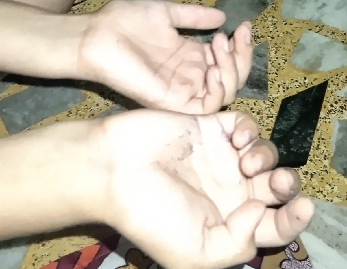 discoverrehan's tweet photo. @NCPCR_ This is how teacher punished my child at SLJ school Hakampur Hasanpur Amroha I need action https://t.co/jE0LdsyMBP