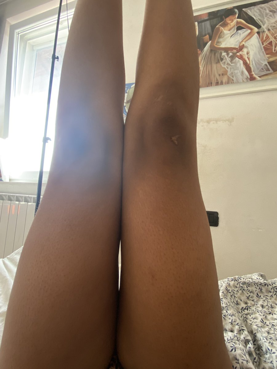 _nyarawr's tweet photo. This tiny gap when I raise my legs, I’m actually going insane why it isn’t like this always  #edtwt #shedtwt https://t.co/aFEdExxv65