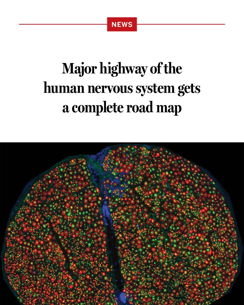 NewsfromScience's tweet photo. Scientists have created the first comprehensive map of the human vagus nerve, tracing thousands of individual nerve fibers stretching from the lower brain stem to all major organs. 

The map might help scientists and doctors more precisely stimulate the nerve as a potential treatment for conditions such as epilepsy, stroke, and inflammatory diseases.

Learn more: https://t.co/KsjHgaVLK6