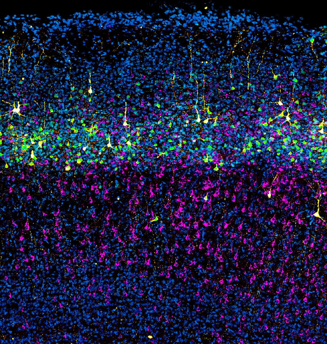 CNB_CSIC's tweet photo. Un equipo del #CNB_CSIC revela que la corteza cerebral se desarrolla a partir de 2 linajes neuronales y no siguiendo un único programa secuencial

También identifica un factor de transcripción que actúa como interruptor y decide qué neurona se producirá

👉https://t.co/gz4O1paejR https://t.co/9gwoJP0ts5