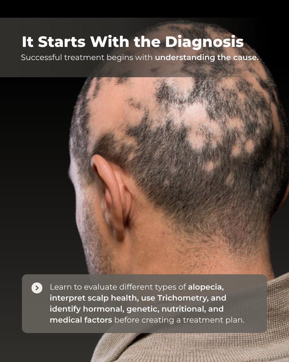 EmpireMedical's tweet photo. 💡 Things You Didn't Know About Hair Restoration Training

Hair restoration is no longer just about PRP. Today's patients expect comprehensive, personalized treatment plans—and that's exactly what you'll learn with Empire Medical Training.

>> https://t.co/PWOfhjiDgh https://t.co/cGruWC38lM
