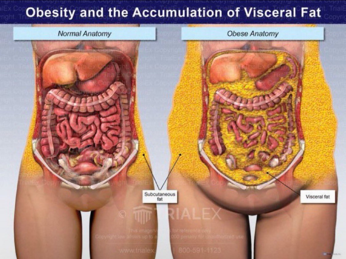 offpuddings's tweet photo. thinking about this image again esp after learning asians hold more visceral fat 💔 https://t.co/l2m2Fak620