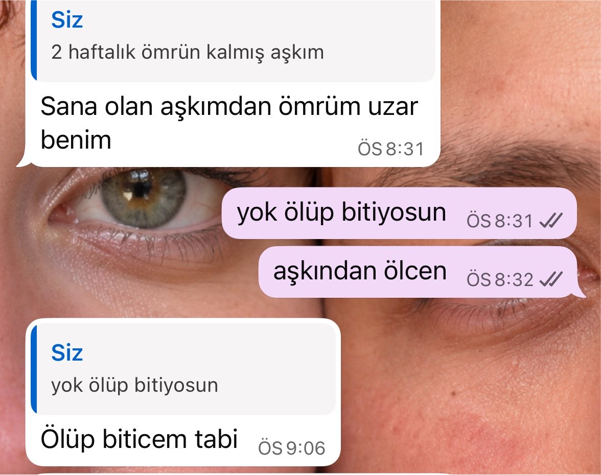 cicikuss31's tweet photo. dedim bu arada🫵🏻🫵🏻🫵🏻 https://t.co/nFYSRb2lGT