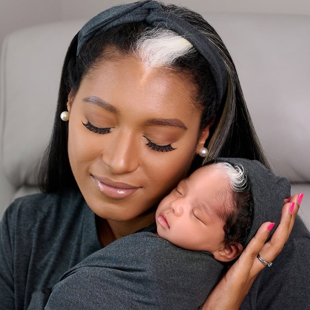 AcervoCharts's tweet photo. Bebê nasce com uma mecha de cabelo branco idêntica à da mãe. https://t.co/mLbb1DWgiN