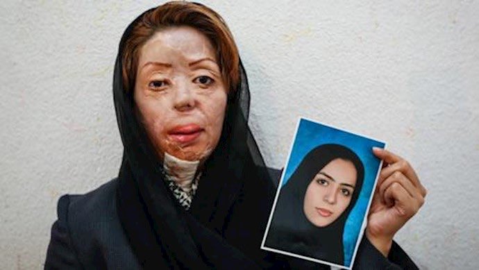 lili_elii's tweet photo. بنظرم مهرنوش بادپر‌ توی آثارش اغراق میکنه و داره فرهنگ ایرانی رو بد جلوه میده. معلوم نیست اینا کجا و توی چه خانواده‌هایی بزرگ شدن که انقدر دید سیاهی به جامعه دارن. من به‌شخصه هیچ‌وقت ندیدم که جامعه متمدن و فرهیخته ما نگاه بدی به زن‌ها داشته باشه https://t.co/cOfvAVGa1j