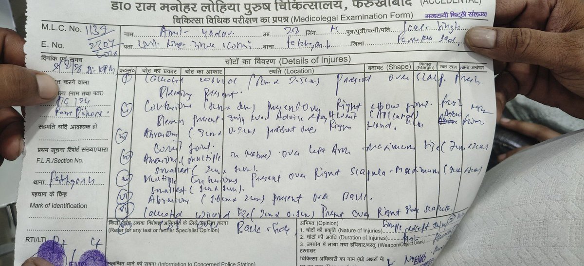PkYadav410216's tweet photo. आज यह पीड़ित व्यक्ति अमित यादव निवासी सिविल लाइन तिर्वा कोठी फतेहगढ़ जनपद फर्रुखाबाद @DMFarrukhabadUP @fatehgarhpolice @FatehgarhsahibP पूरे अपने जिले में और तहसील में एक एफआईआर दर्ज करने के लिए घूम रहा है लेकिन प्रशासन बैठा सावंतवादियों के दबाव में एक FIR पीड़ित की नहीं लिख पा रहा है बड़े शर्म की बात है अच्छी बात है आप  बड़े लोगों का साथ दो लेकिन कानून प्रशासन गुंडो को सजा देने के लिए बनाया गया है कमजोरों को बचाने के लिए बनाया गया है तो यह तो फर्ज निभाओ 
 
@Uppolice
महोदय फर्रुखाबाद फतेहगढ़ का प्रशासन नाकाम रहा 
कृपया करके अब आप इस मामले को संज्ञान में लें 
अमित यादव मेडिकल पर थे अपने और शाम को कई गुंडे आते हैं और हमला कर देते हैं उनके गले से दो तोले की सोने की चैन भी ले जाते हैं और दिन भर की कमाई ₹17000 भी लूट ले जाते हैं सिर्फ शर्म की बात यह है की FIR नहीं दर्ज हो रही है और अगर आपके कहने से FIR दर्ज हो भी जाएगी महोदय तो क्या गारंटी है कि उन गुंडो के ऊपर कार्रवाई होगी
निवेदन है महोदय कार्रवाई करें जल्द