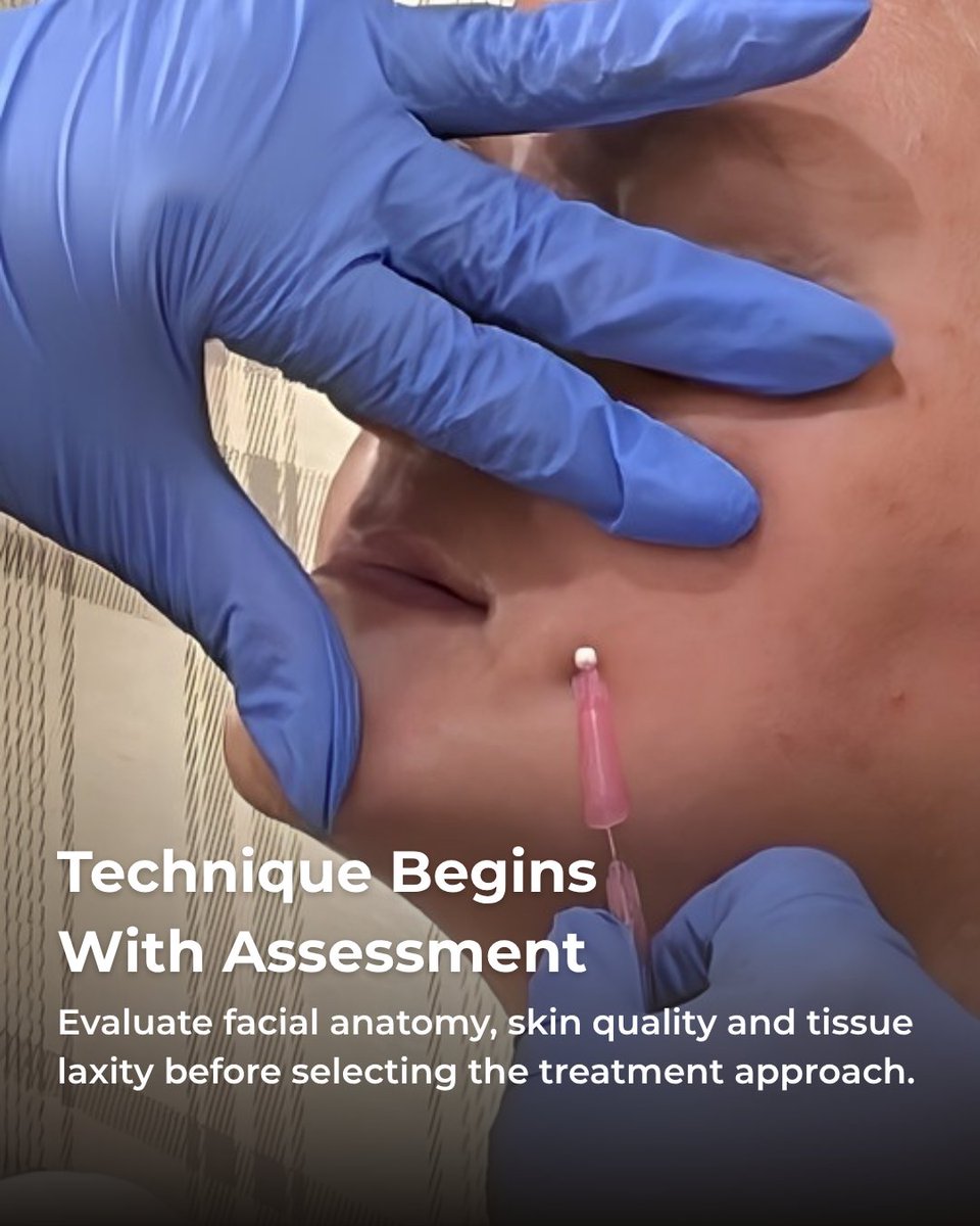 EmpireMedical's tweet photo. Master the art of PDO Threads – Level I and elevate your aesthetic practice. ✨
Build confidence through hands-on training and expert-guided instruction designed for medical professionals looking to expand their skills. >> https://t.co/9g4JHDnQOL https://t.co/pmrRtd2WUq