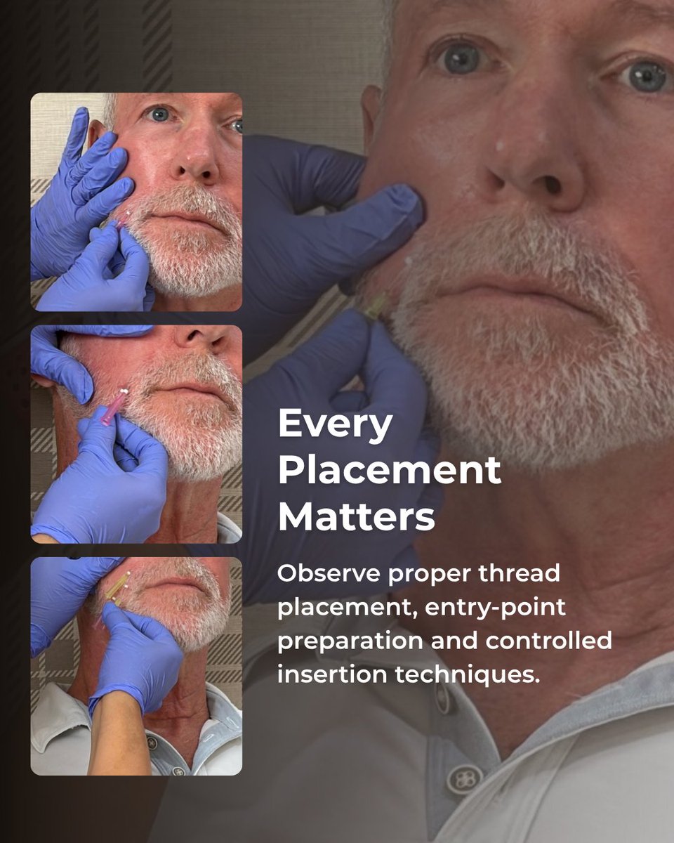 EmpireMedical's tweet photo. Master the art of PDO Threads – Level I and elevate your aesthetic practice. ✨
Build confidence through hands-on training and expert-guided instruction designed for medical professionals looking to expand their skills. >> https://t.co/9g4JHDnQOL https://t.co/pmrRtd2WUq