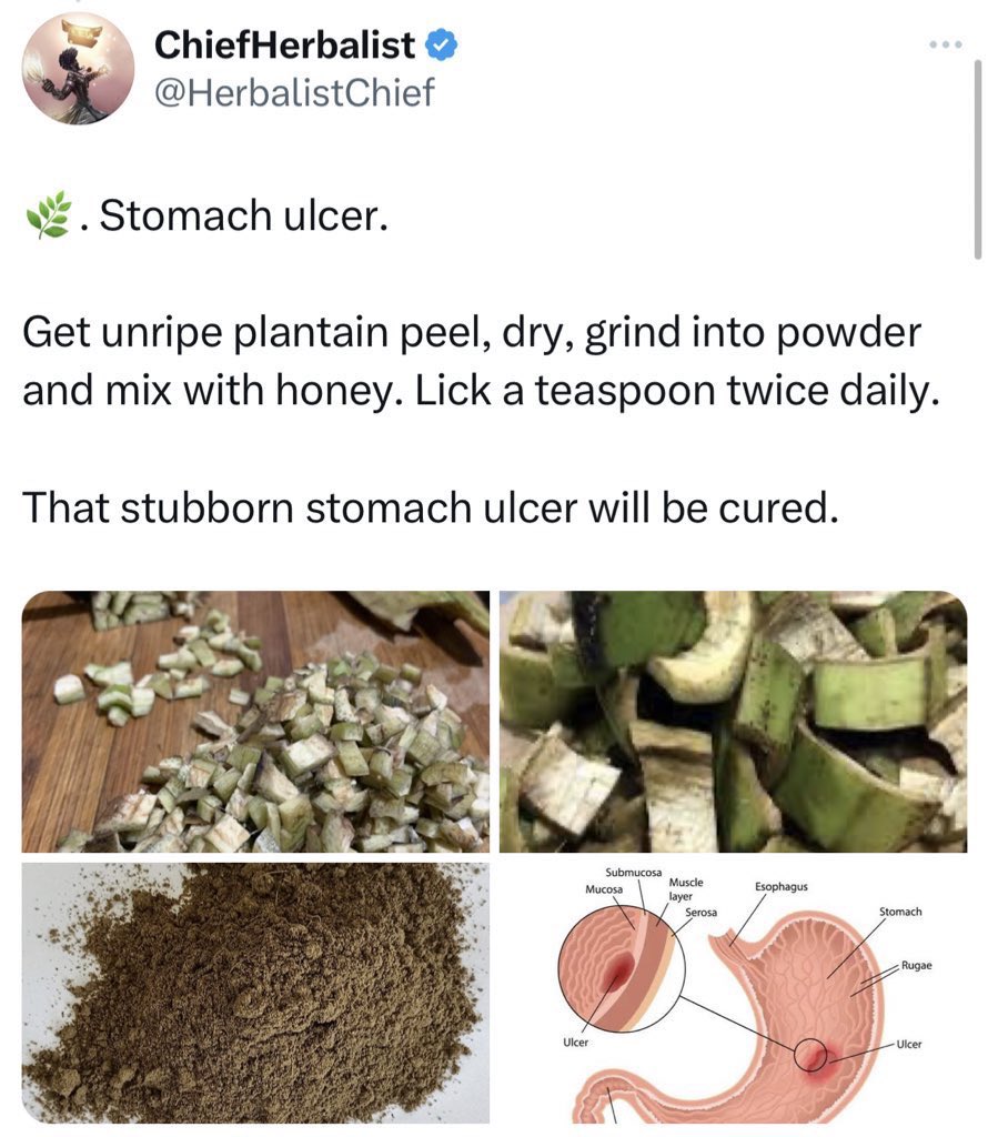 HerbalistChief's tweet photo. Stomach ulcer of 13 years cured successfully with unripe plantain peels. 

Nature heals. https://t.co/JgLeK0dfBo