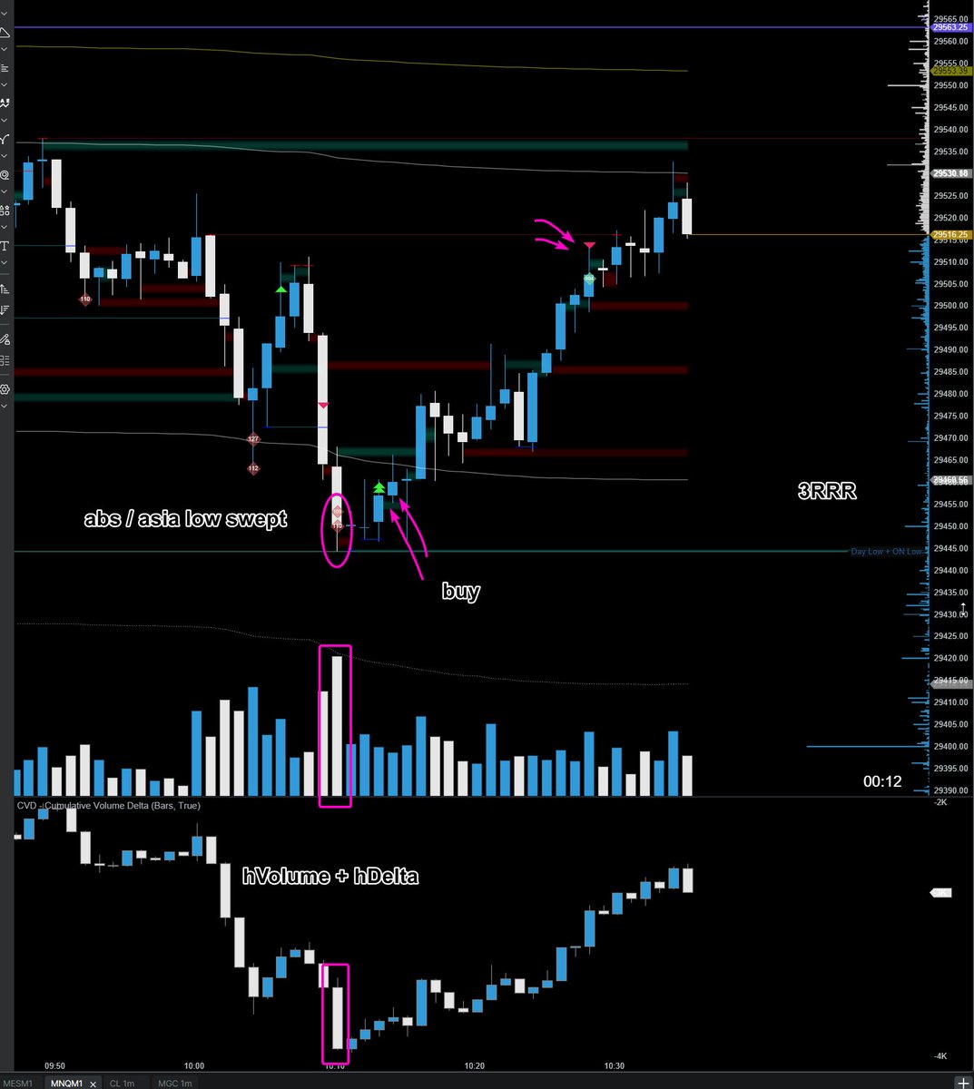 ViaAscendary's tweet photo. London swept the Asia Low.
Order flow confirmed the entry.
Back to value. 🎯

Another clean execution from Sensei.

#NQ #MNQ #QQQ #Nasdaq #NasdaqFutures #EminiNasdaq #MicroNasdaq #NDX https://t.co/TTawMg1Fie