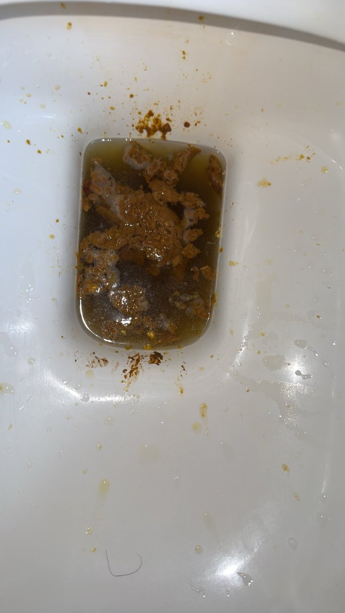 jamesmack633's tweet photo. Diarrhea😍🤭
You like that?
#diarrhea #poop #ToiletTalk #BathroomChronicles #ToiletHumor #PoopHumor #PoopPosting #PoopThoughts #DiariesOfDiarrhea #DiarrheaLife #EmergencyPoop #RestroomStories #BathroomFails #ToiletFails #StomachProblems #GutTrouble #IBSProblems #LooseStools https://t.co/XH4mXh4GVG