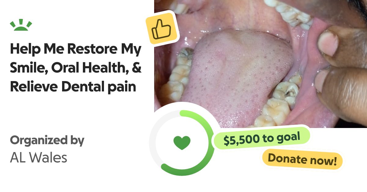 dadyminds's tweet photo. β€οΈ Help AL Restore His Oral Health β€οΈ
π https://t.co/fL7YVFkrWD
#Fundraiser #DentalHealth #DentalCare #OralHealth #DentalEmergency #ToothDecay #DentalTreatment #HealthcarE #MediealSupport #HealthAndWellness #SupportNeeded #HelpSomeoneInNeed #Crowdfunding #GoFundMe https://t.co/NjX1QwLRIE